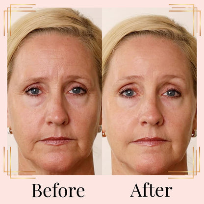 Nakery Retinol Eye Cream - Anti Wrinkle Face Cream with Hyaluronic Acid Face Tightening Serum - Wrinkle Cream for Under Eye - Instant Wrinkle Remover Serum 50ml
