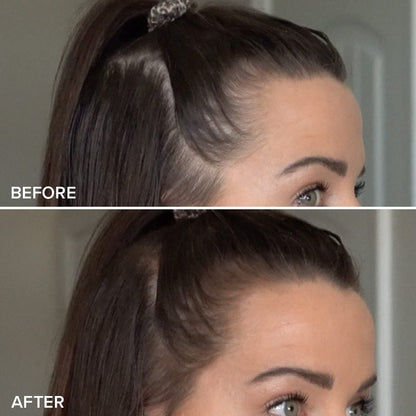 TRUHAIR Color & Conceal Waterproof Root Touch Up Hair Color Concealer - Hair Cover up for Gray Coverage and Hairline Filling - 11 Hair Colors Available